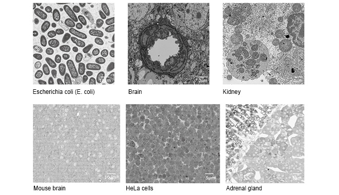 High-Speed, High-Resolution 3D Reconstruction: CIQTEK Volumetric Electron Microscopy Solution Unlocks New Dimensions in Biological Characterization